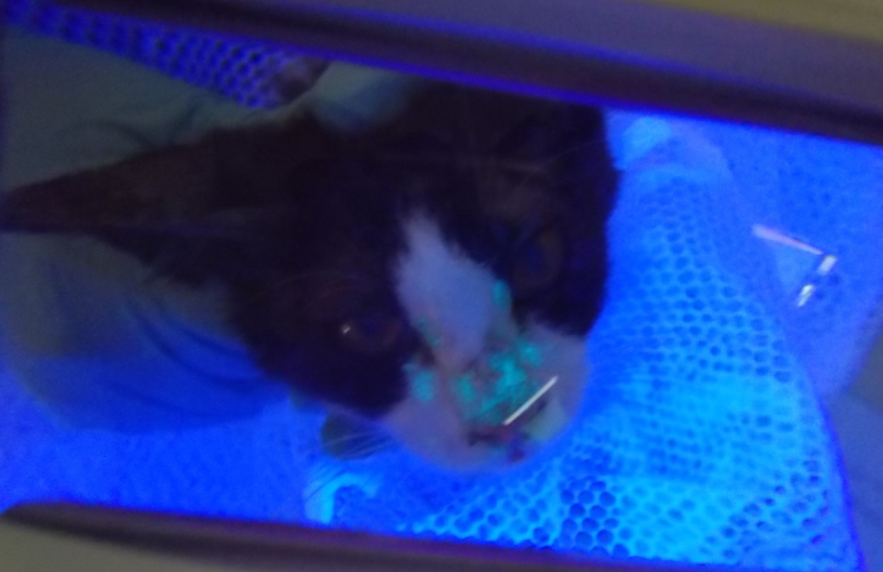 ウッド灯検査で発光を認める真菌性皮膚炎病変