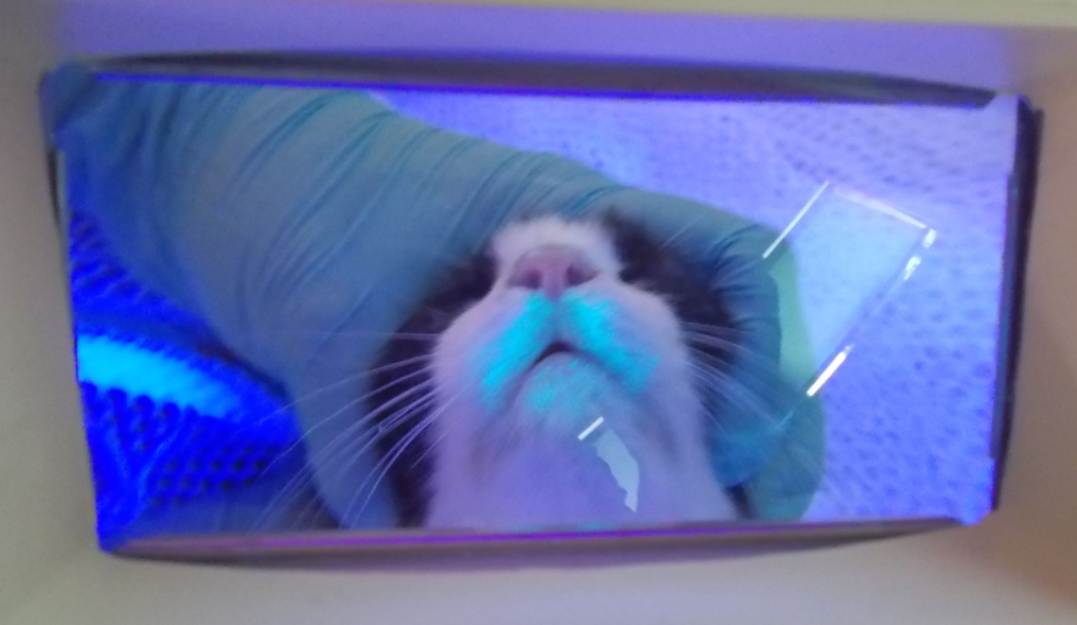 ウッド灯検査で発光を認める真菌性皮膚炎病変